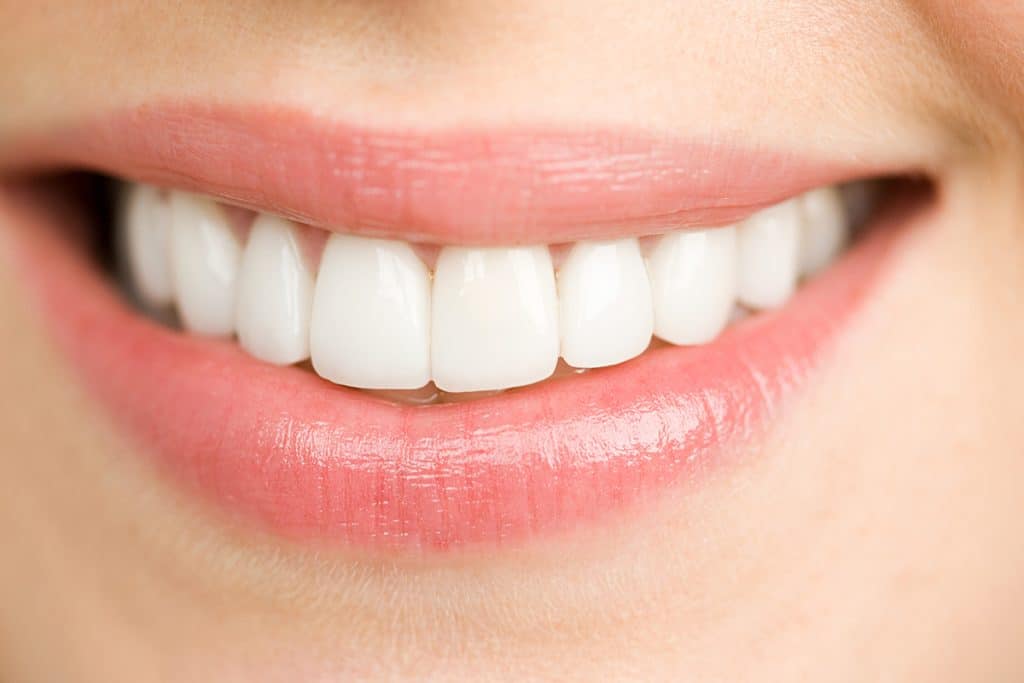 How Long Does Professional Teeth Whitening Last?