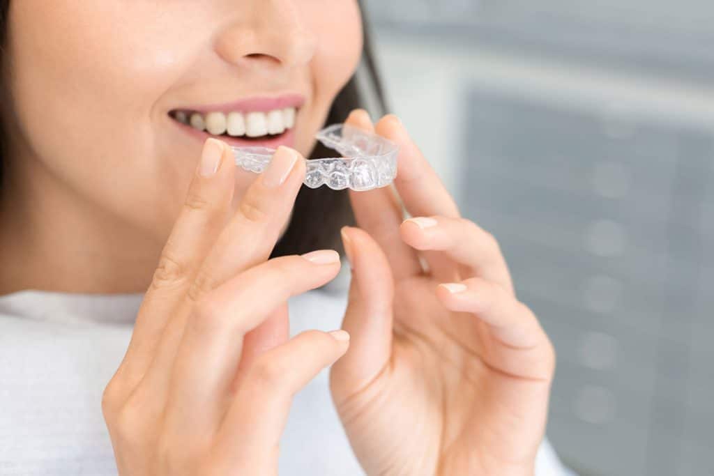 How Much Does Invisalign Cost in Leesburg, VA?